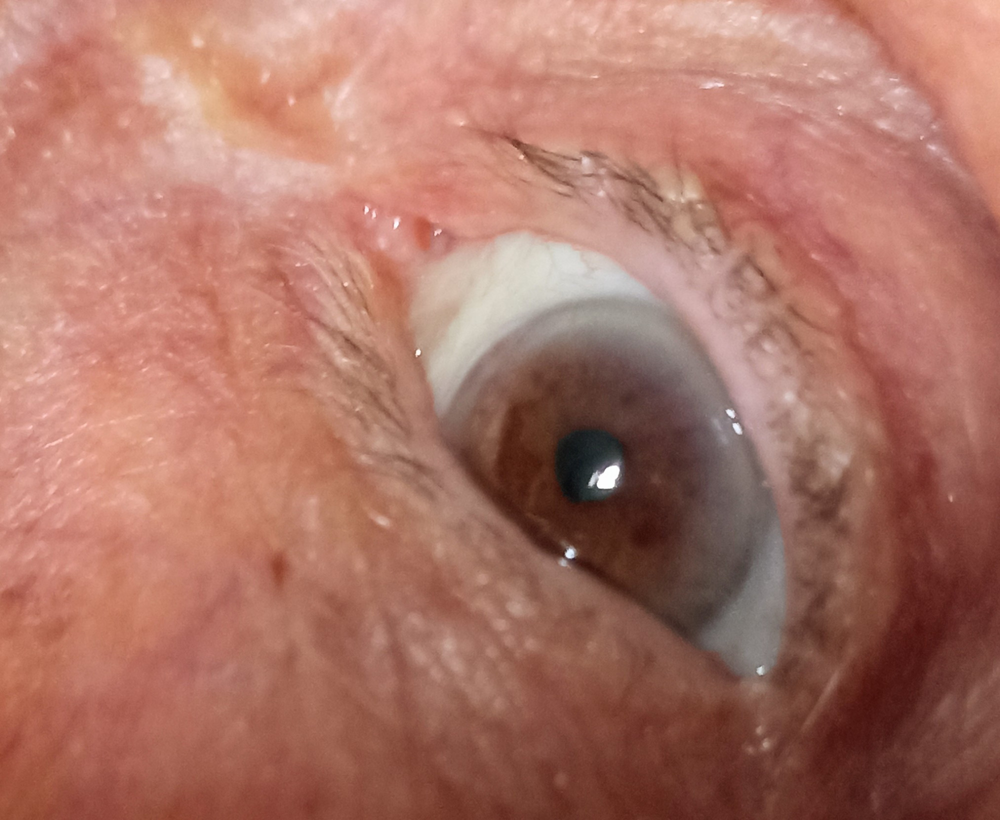 Olhos que vêem,
Do que o tempo apagou.
Que relembram imagens,
Da vida que levou.
Dos filhos que viu crescer,
E dos que a morte, 
Tão cedo podou.
De tudo que plantou, 
Colheu e chorou.
As lágrimas mais tristes,
Que a face enrugada marcou.
Olhos hazel,
Que mudaram
Conforme os sentimentos.
Cinza, verde, mel.
Carregam o peso da perda,
Se alegram com seus descentes.
O riso das netas, netos e bisnetas.
O dinheirinho sempre escondido, passando de mão em mão.
Presente aniversário, 
Transformando papel em coração. 

Eliz Leão